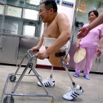 Dalla Cina un modello per tutti i mutilati: Peng Shulin, l’incredibile uomo a metà