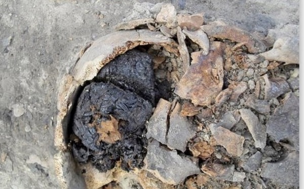 Turchia: trovato un cervello vecchio di 4.000 anni ancora in buono stato di conservazione